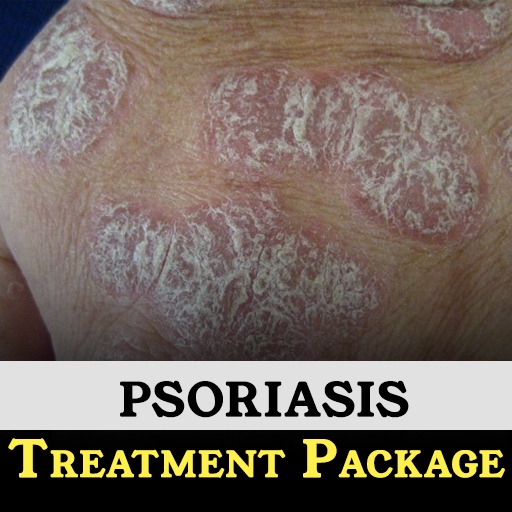 PSORIASIS TREATMENT PACKAGE 1